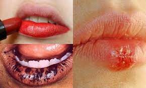 Sử dụng son môi chứa nhiều chì